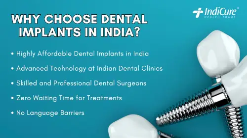 Why Choose Dental Implants in India?